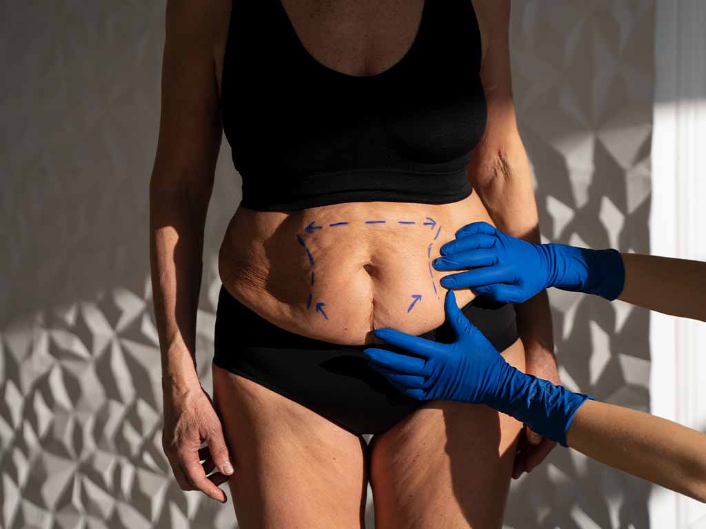cirurgia plástica reparadora plano de saúde